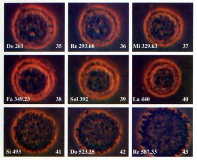 Cellula cancerosa Hela durante l'esperimento eseguito con lo xilofono